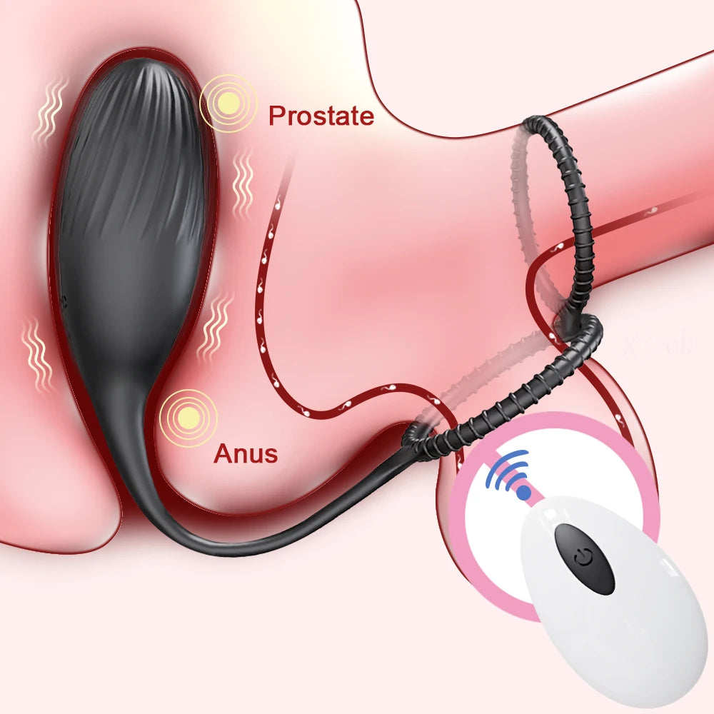 App-Controlled Prostate Massager Set