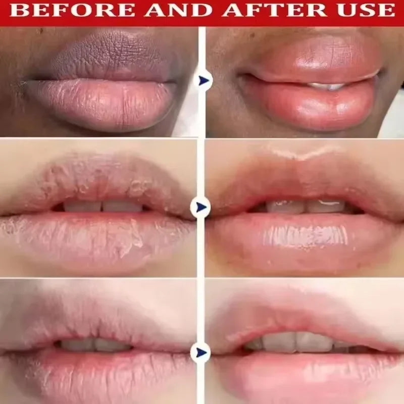 Fast Lighten Melanin Lip Mask Remove Dark Lip Balm Serum Exfoliating Fade Lip Lines Dead Skin Nourishing Repair Lip Care Makeup