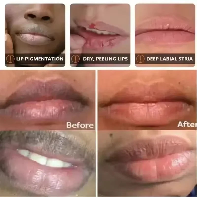 Fast Lighten Melanin Lip Mask Remove Dark Lip Balm Serum Exfoliating Fade Lip Lines Dead Skin Nourishing Repair Lip Care Makeup